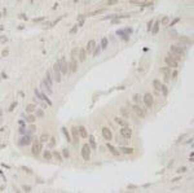 Immunohistochemistry-Paraffin ANKRD28 Antibody