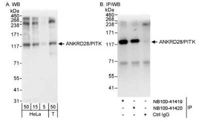 Western Blot ANKRD28 Antibody