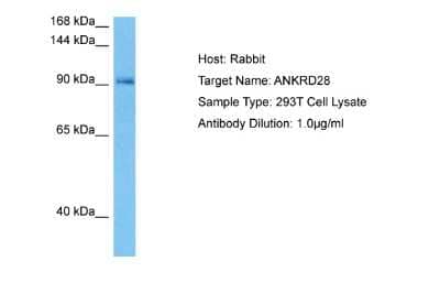 Western Blot ANKRD28 Antibody - BSA Free