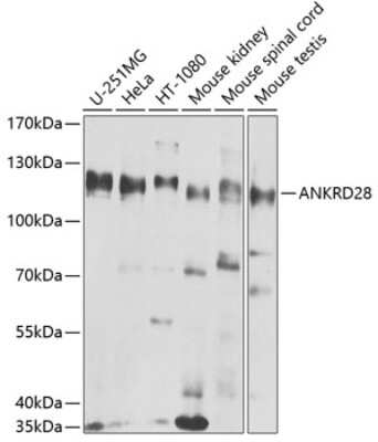 Western Blot ANKRD28 Antibody - BSA Free