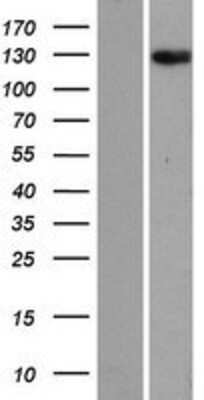Western Blot: ANKRD28 Overexpression Lysate (Adult Normal) [NBP2-07201] Left-Empty vector transfected control cell lysate (HEK293 cell lysate); Right -Over-expression Lysate for ANKRD28.