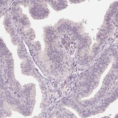 Immunohistochemistry-Paraffin: ANKRD31 Antibody [NBP2-49261] - Staining of human fallopian tube shows low expression as expected.