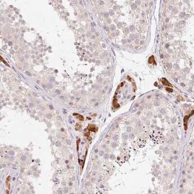 Immunohistochemistry-Paraffin: ANKRD31 Antibody [NBP2-49261] - Staining of human testis shows high expression.