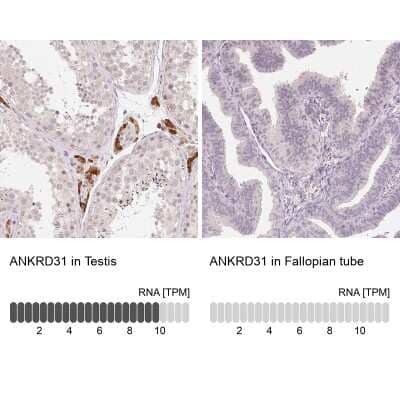 Immunohistochemistry-Paraffin: ANKRD31 Antibody [NBP2-49261] - Staining in human testis and fallopian tube tissues using anti-ANKRD31 antibody. Corresponding ANKRD31 RNA-seq data are presented for the same tissues.