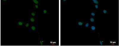 Immunocytochemistry/Immunofluorescence: ANKRD32 Antibody [NBP2-15399] - U87-MG cells were fixed in 4% paraformaldehyde at RT for 15 min. Green: ANKRD32 protein stained by ANKRD32 antibody diluted at 1:500. Blue: Hoechst 33342 staining. Scale bar = 10 um.