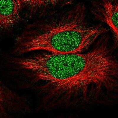 Immunocytochemistry/Immunofluorescence: ANKRD32 Antibody [NBP2-76546] - Staining of human cell line HeLa shows localization to nucleus. Antibody staining is shown in green.