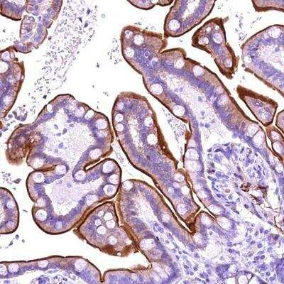 Immunohistochemistry-Paraffin: ANKRD32 Antibody [NBP1-88358] - Staining of human colon shows strong membranous positivity in glandular cells.