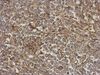 Immunohistochemistry-Paraffin: ANKRD32 Antibody [NBP2-15399] - Paraffin-embedded Hela xenograft, using antibody at 1:500 dilution.