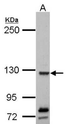 Western Blot: ANKRD32 Antibody [NBP2-15399] - Sample (30 ug of whole cell lysate) A: PC-3 5% SDS PAGE; antibody diluted at 1:1000.