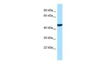 Western Blot: ANKRD33 Antibody [NBP2-84429] - WB Suggested Anti-ANKRD33 Antibody. Titration: 1.0 ug/ml. Positive Control: MCF7 Whole Cell