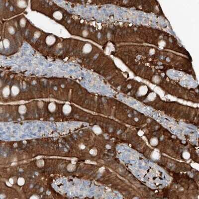 Immunohistochemistry-Paraffin: ANKRD34A Antibody [NBP1-90855] - Staining of human duodenum shows strong cytoplasmic and membrane positivity in glandular cells.
