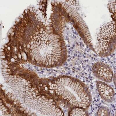 Immunohistochemistry-Paraffin ANKRD34B Antibody - BSA Free