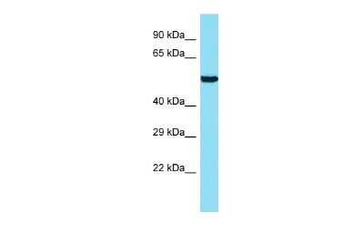Western Blot ANKRD34B Antibody - BSA Free