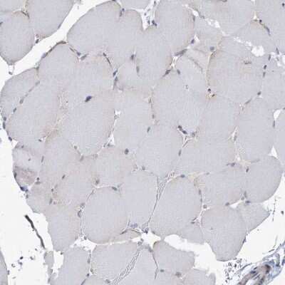 Immunohistochemistry-Paraffin ANKRD35 Antibody - BSA Free