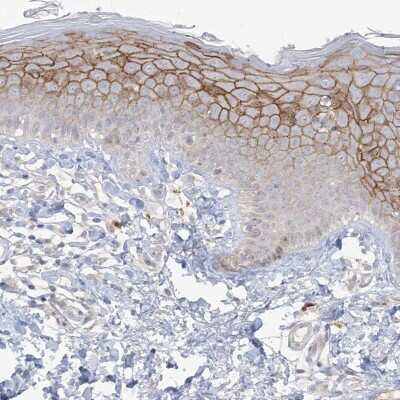 Immunohistochemistry-Paraffin ANKRD35 Antibody - BSA Free