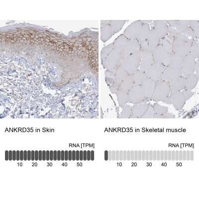 Immunohistochemistry-Paraffin ANKRD35 Antibody - BSA Free