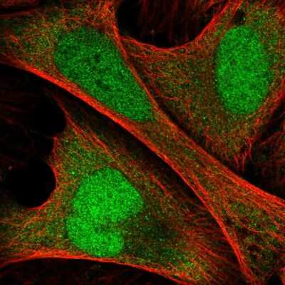 Immunocytochemistry/Immunofluorescence: ANKRD36C Antibody [NBP2-54945] - Staining of human cell line U-2 OS shows localization to nucleus & cytosol.