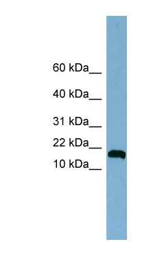 Western Blot: ANKRD37 Antibody [NBP1-55347] - Titration: 0.2-1 ug/ml, Positive Control: Jurkat cell lysate.