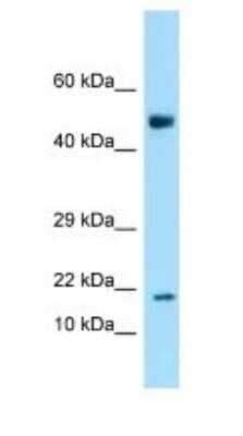 Western Blot ANKRD37 Antibody