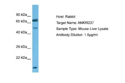 Western Blot ANKRD37 Antibody