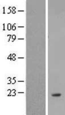 Western Blot: ANKRD37 Overexpression Lysate (Adult Normal) [NBL1-07540] Left-Empty vector transfected control cell lysate (HEK293 cell lysate); Right -Over-expression Lysate for ANKRD37.