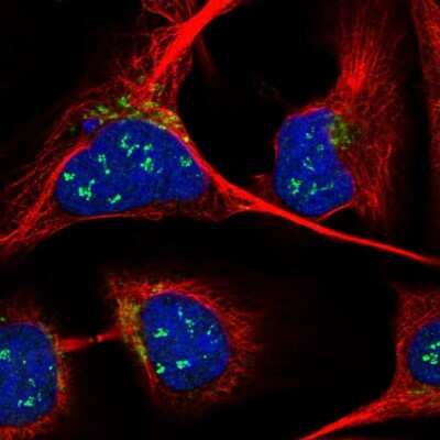 Immunocytochemistry/Immunofluorescence: ANKRD40 Antibody [NBP1-93516] - Immunofluorescent staining of human cell line U-2 OS shows localization to nucleoli & the Golgi apparatus.