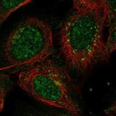 Immunocytochemistry/Immunofluorescence: ANKRD40 Antibody [NBP3-17341] - Staining of human cell line U-2 OS shows localization to nucleoplasm & the Golgi apparatus.