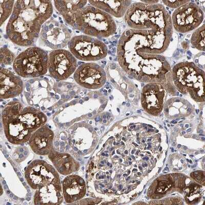 Immunohistochemistry-Paraffin: ANKRD40 Antibody [NBP1-93515] - Staining of human kidney shows moderate cytoplasmic positivity in cells in tubules.