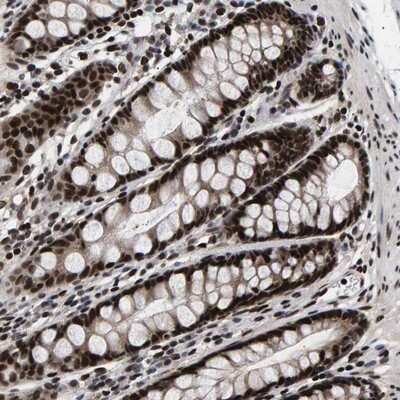 Immunohistochemistry-Paraffin: ANKRD40 Antibody [NBP1-93516] - Staining of human rectum shows strong nuclear positivity in glandular cells.