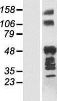 Western Blot: ANKRD40 Overexpression Lysate (Adult Normal) [NBP2-05852] Left-Empty vector transfected control cell lysate (HEK293 cell lysate); Right -Over-expression Lysate for ANKRD40.