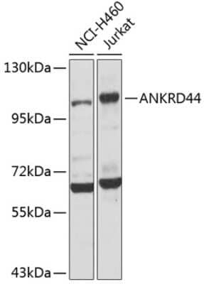 Western Blot: ANKRD44 Antibody [NBP2-92554] - Analysis of extracts of various cell lines, using ANKRD44 at 1:1000 dilution.Secondary antibody: HRP Goat Anti-Rabbit IgG (H+L) at 1:10000 dilution.Lysates/proteins: 25ug per lane.Blocking buffer: 3% nonfat dry milk in TBST.Detection: ECL Basic Kit .Exposure time: 10s.