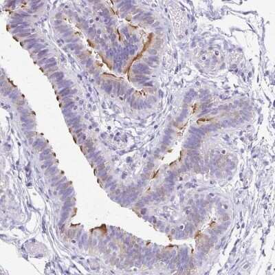 Immunohistochemistry-Paraffin: ANKRD45 Antibody [NBP1-85421] - Staining of human fallopian tube shows high expression.