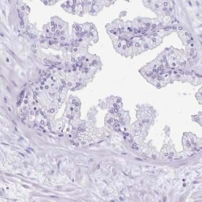 Immunohistochemistry-Paraffin: ANKRD45 Antibody [NBP1-85421] - Staining of human prostate shows low expression as expected.