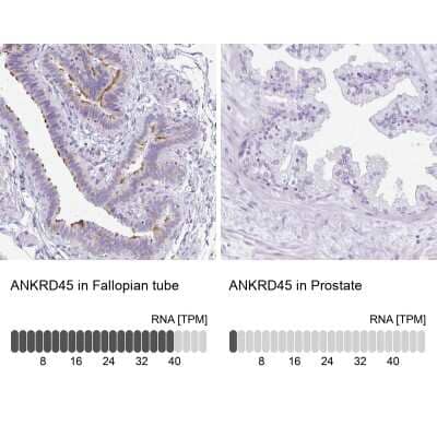 Immunohistochemistry-Paraffin: ANKRD45 Antibody [NBP1-85421] - Staining in human fallopian tube and prostate tissues using anti-ANKRD45 antibody. Corresponding ANKRD45 RNA-seq data are presented for the same tissues.