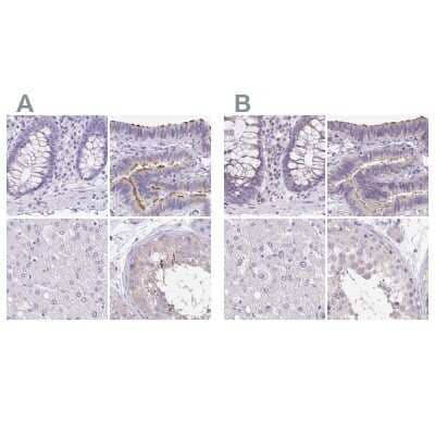 Immunohistochemistry-Paraffin: ANKRD45 Antibody [NBP1-85421] - Staining of human colon, fallopian tube, liver and testis using Anti-ANKRD45 antibody NBP1-85421 (A) shows similar protein distribution across tissues to independent antibody NBP1-85423 (B).