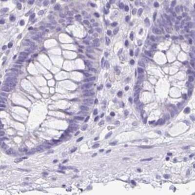 Immunohistochemistry-Paraffin: ANKRD45 Antibody [NBP1-85421] - Staining of human colon.