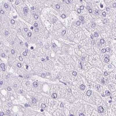 Immunohistochemistry-Paraffin: ANKRD45 Antibody [NBP1-85421] - Staining of human liver.