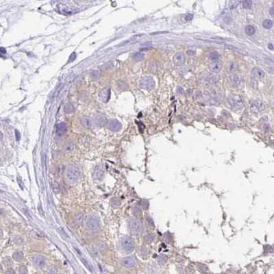 Immunohistochemistry-Paraffin: ANKRD45 Antibody [NBP1-85421] - Staining of human testis.