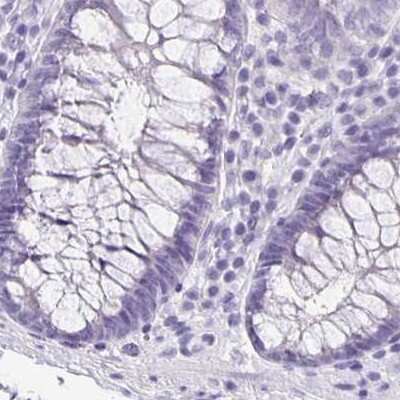 Immunohistochemistry-Paraffin: ANKRD45 Antibody [NBP1-85422] - Staining of human colon.