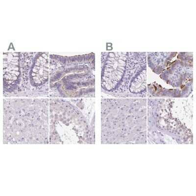 <b>Independent Antibodies Validation. </b>Immunohistochemistry-Paraffin: ANKRD45 Antibody [NBP1-85423] - Staining of human colon, fallopian tube, liver and testis using Anti-ANKRD45 antibody NBP1-85423 (A) shows similar protein distribution across tissues to independent antibody NBP1-85422 (B).