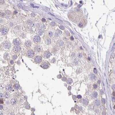 Immunohistochemistry-Paraffin: ANKRD45 Antibody [NBP1-85423] - Staining of human testis.