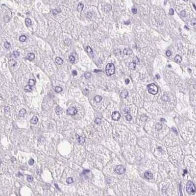 Immunohistochemistry-Paraffin: ANKRD45 Antibody [NBP1-85423] - Staining of human liver.