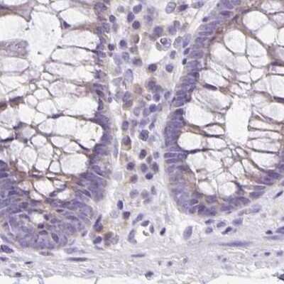 Immunohistochemistry-Paraffin: ANKRD45 Antibody [NBP1-85423] - Staining of human colon.
