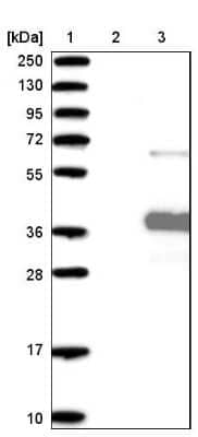 Western Blot: ANKRD45 Antibody [NBP1-85421] - Lane 1: Marker [kDa] 250, 130, 95, 72, 55, 36, 28, 17, 10. Lane 2: Negative control (vector only transfected HEK293T lysate). Lane 3: Over-expression lysate (Co-expressed with a C-terminal myc-DDK tag (3.1 kDa) in mammalian HEK293T cells).