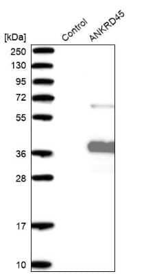 Western Blot: ANKRD45 Antibody [NBP1-85421] - Analysis in control (vector only transfected HEK293T lysate) and ANKRD45 over-expression lysate (Co-expressed with a C-terminal myc-DDK tag (3.1 kDa) in mammalian HEK293T cells).