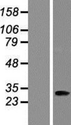 Western Blot: ANKRD45 Overexpression Lysate (Adult Normal) [NBP2-04687] Left-Empty vector transfected control cell lysate (HEK293 cell lysate); Right -Over-expression Lysate for ANKRD45.
