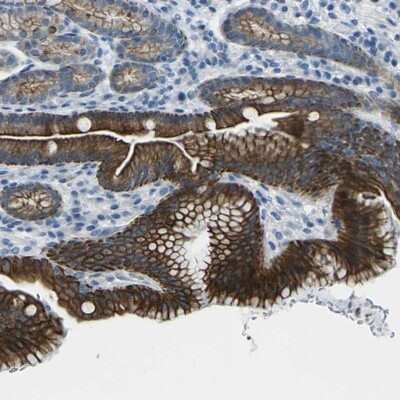 Immunohistochemistry-Paraffin ANKRD46 Antibody