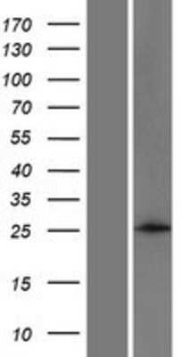 Western Blot: ANKRD46 Overexpression Lysate (Adult Normal) [NBP2-04733] Left-Empty vector transfected control cell lysate (HEK293 cell lysate); Right -Over-expression Lysate for ANKRD46.