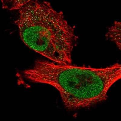 Immunocytochemistry/Immunofluorescence: ANKRD49 Antibody [NBP1-83902] - Immunofluorescent staining of human cell line U-251 MG shows localization to nucleoplasm.