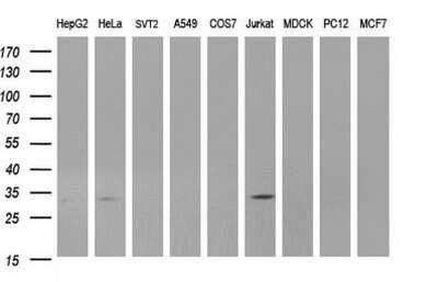 Western Blot: ANKRD49 Antibody (OTI3E4) - Azide and BSA Free [NBP2-71971] - Analysis of extracts (35ug) from 9 different cell lines (HepG2: human; HeLa: human; SVT2: mouse; A549: human; COS7: monkey; Jurkat: human; MDCK: canine; PC12: rat; MCF7: human).